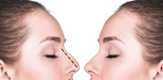 Rising Trend: Non-surgical Rhinoplasty